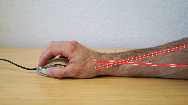 Horizontale Maus – hohe Spannungen im Arm, gekennzeichnet mit zwei roten Strichen